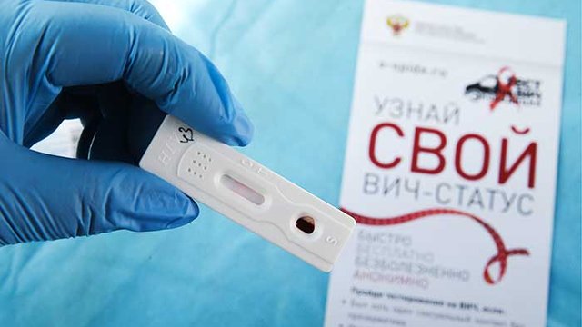 Рост заболевших ВИЧ в России отмечают эпидемиологи